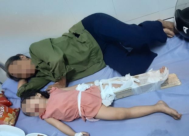Học sinh ở Hà Nội ngã gãy chân tại trường: Phụ huynh &#39;tố&#39; hiệu trưởng vô cảm - 1