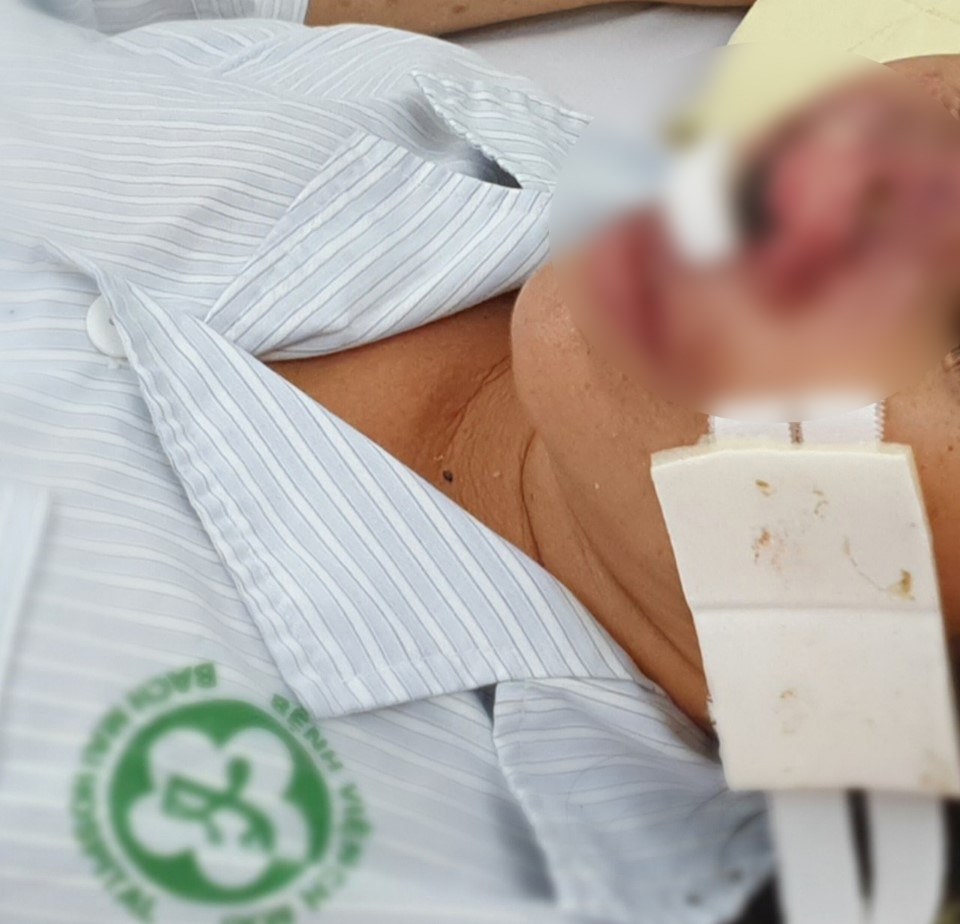 Những dấu hiệu nhận biết người mắc vi khuẩn whitmore ăn mòn cơ thể, có thể chết sau 48 giờ - 1