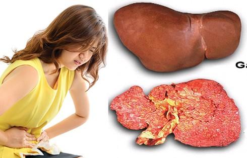 Căn bệnh ung thư đứng đầu Việt Nam: Bất ngờ "thủ phạm" từ người mẹ - 1