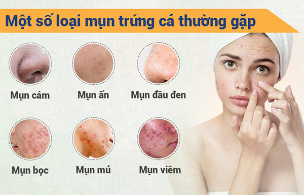 Sau bao lâu sử dụng serum trị mụn 24h, ta có thể thấy kết quả rõ rệt?
