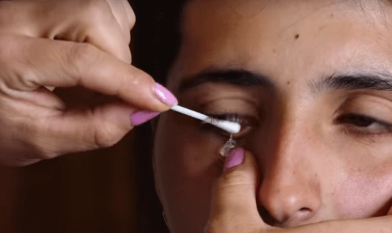 Căn bệnh kỳ lạ khiến cô gái khóc ra "pha lê" - 2