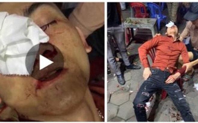 Tin tức 24h qua: Sở TT&TT lý giải việc Hà Nội chậm thanh toán với Viettel - 4