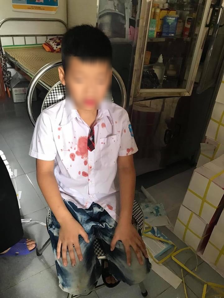 Vụ phụ huynh đánh học sinh lớp 1 dãn man: “Cháu vẫn hoảng sợ, không muốn đến trường” - 1