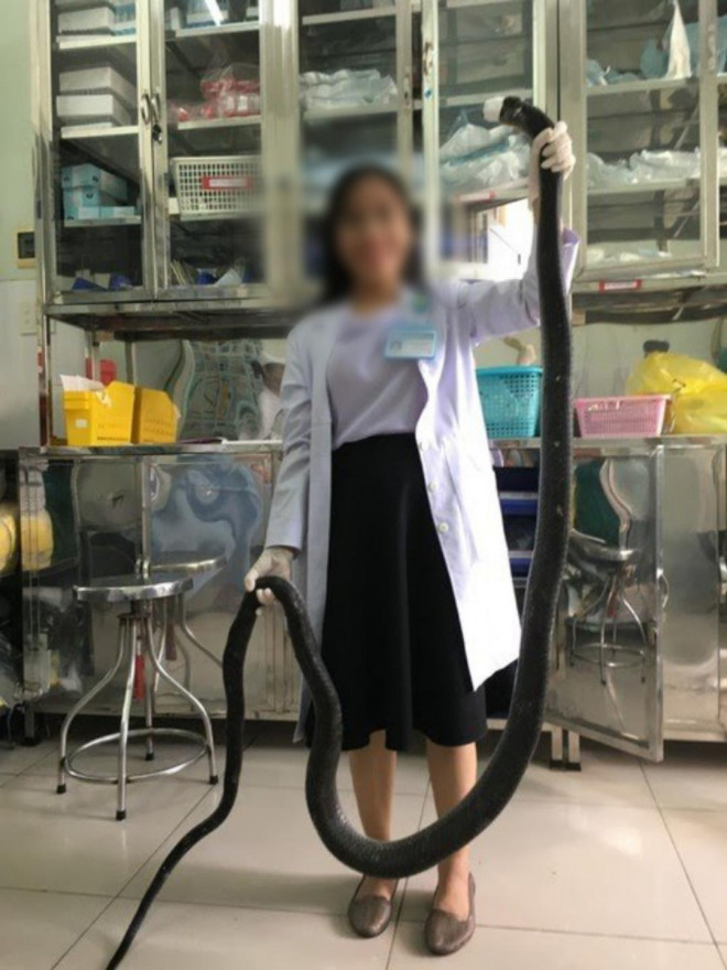 Nọc độc rắn hổ mang chúa 4,6kg ở núi Bà Đen và "cuộc lội ngược dòng" của nạn nhân - 2