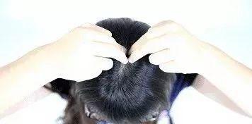 Cơ thể con người có 5 &#34;công tắc&#34; để mọc tóc, hãy bấm mỗi ngày để ngăn rụng tóc và tạm biệt hói đầu - 1