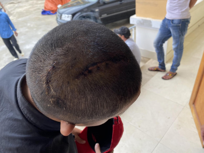 Đêm kinh hoàng trên tàu câu mực - 2