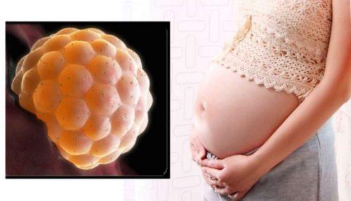 Từ vụ cô gái 20 tuổi bị chửa trứng: Những dấu hiệu đặc biệt quan trọng chị em cần lưu ý để phát hiện sớm tình trạng bất thường thai nghén này - 1
