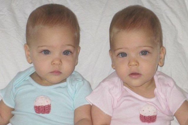 Cặp song sinh đẹp nhất thế giới, 6 tháng tuổi đã đi quảng cáo giờ ra sao? - 1