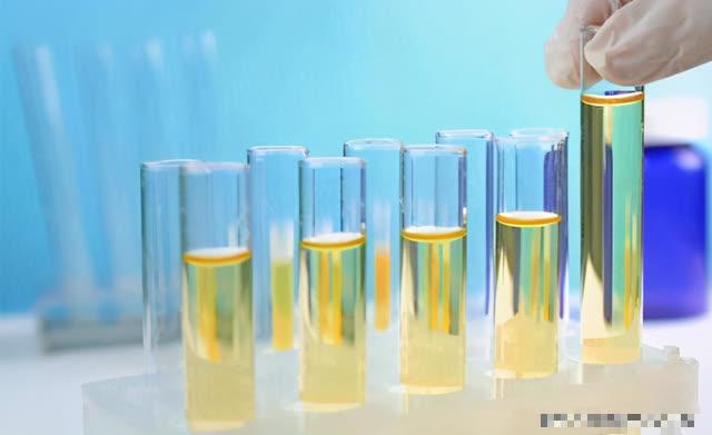 Người gan xấu có 3 biểu hiện khi đi vệ sinh, hãy tránh 6 hành vi này hằng ngày - 1