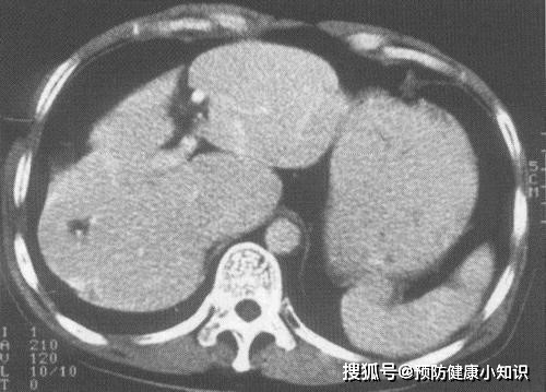 3 thứ trong bếp không được rửa đúng cách và thay thường xuyên có thể gây ung thư gan - 1