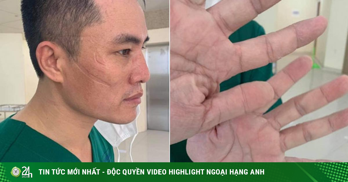 Nghẹn ngào bài thơ nghĩa tình của nam điều dưỡng trên tuyến đầu chống dịch COVID-19 - Vimarsana News