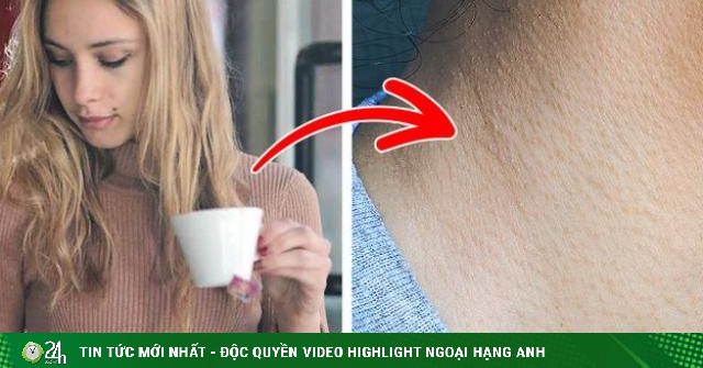 Cách phòng ngừa và trị chứng da gà xấu xí vào mùa hè - Vimarsana News