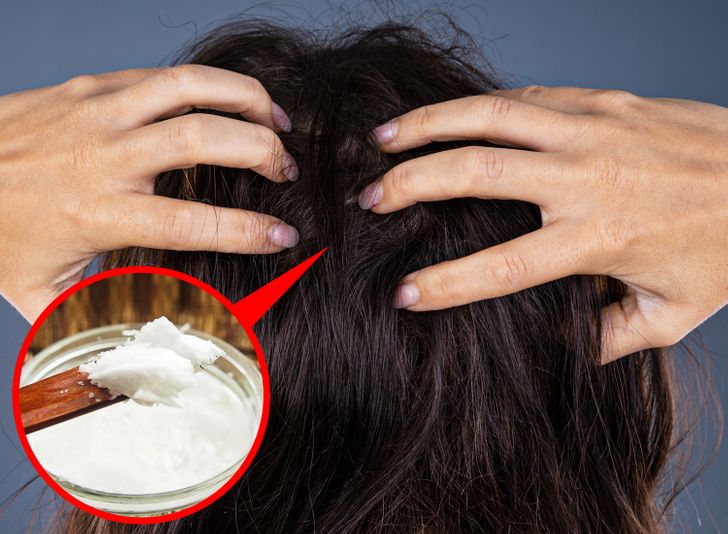 Những quyết giúp bạn "phủ xanh đồi bạc", lấy lại mái tóc tuổi đôi mươi - 5