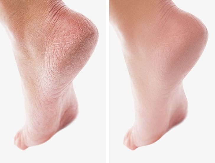 Loạt mẹo làm đẹp cực rẻ giúp răng trắng, triệt lông, da mềm như nhung - 10