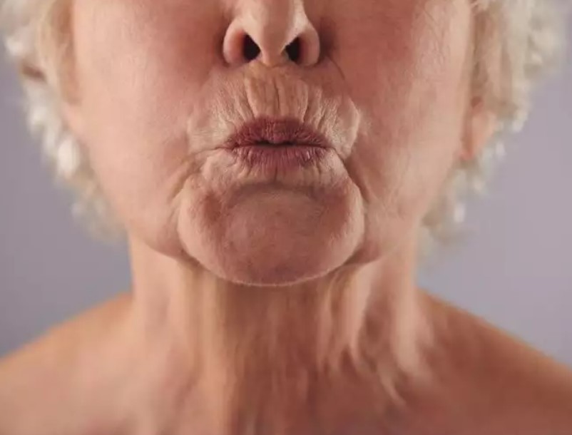 Bài tập thở hỗ trợ phục hồi cho bệnh nhân COVID-19 - 4