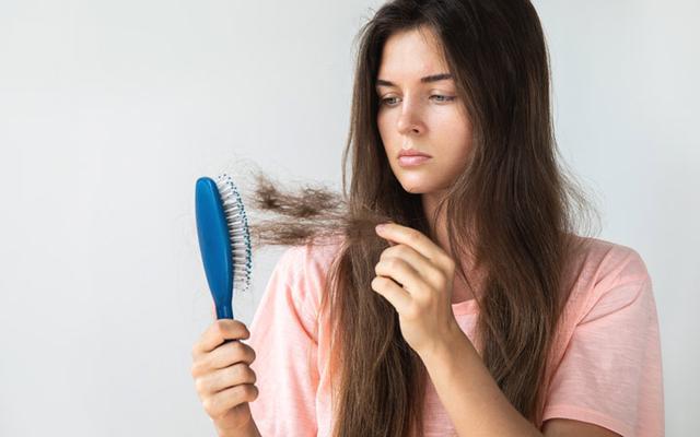Nước ép hành, gừng giúp chàng hói mọc tóc nhanh - 3