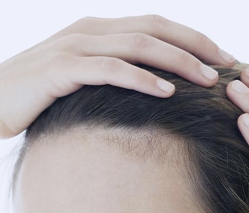 3 nguyên tắc để ngăn tóc rụng tả tơi như lá mùa thu - 1