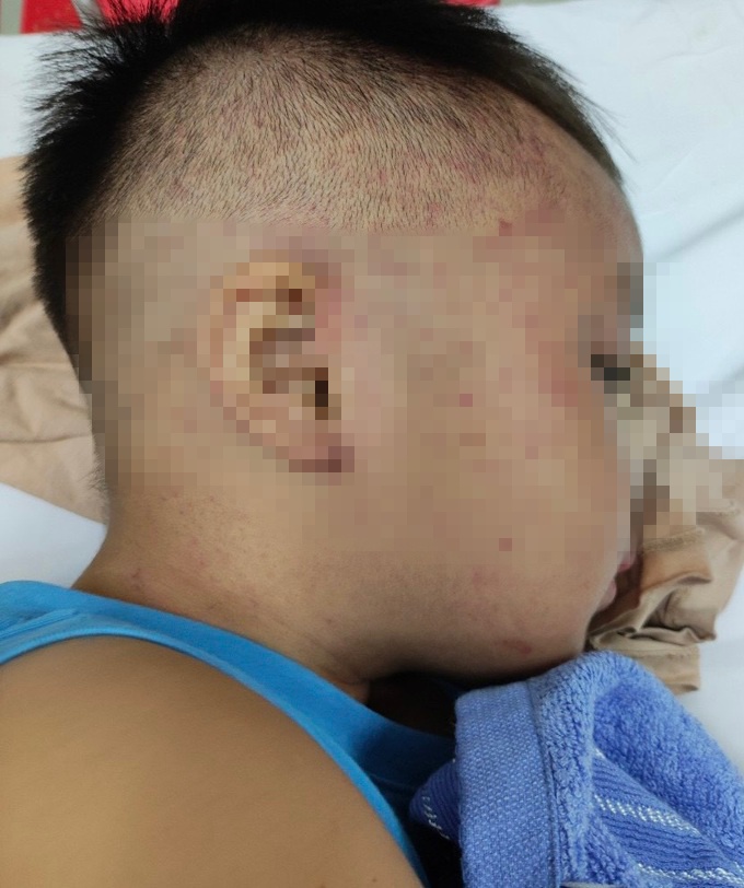 Nghi án bé 3 tuổi bị hàng xóm đánh, cho vào tủ đông lạnh ở Hà Nam - 1