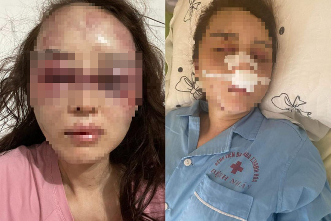 Tin tức 24h qua: Nguyên nhân cán bộ QLTT ở Thanh Hóa đánh đập bạn gái dã man - 1