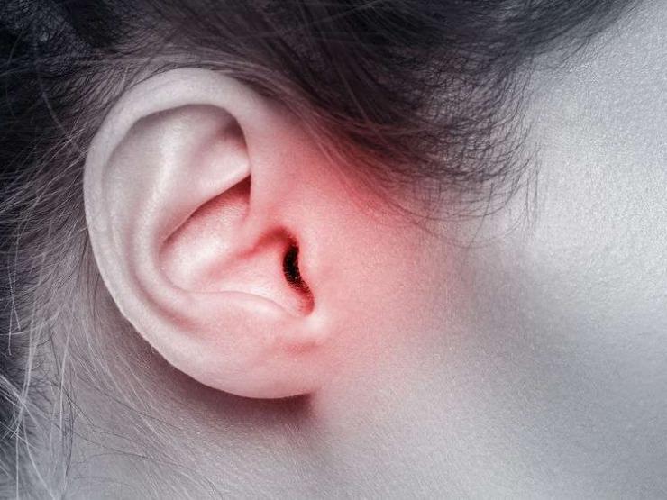 Đừng chủ quan khi bị ù tai, đây có thể là dấu hiệu của 3 căn bệnh nguy hiểm