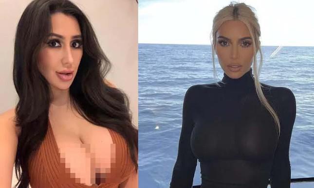 Người phụ nữ Hàn Quốc phẫu thuật 15 lần để thành bản sao Kim Kardashian - 1