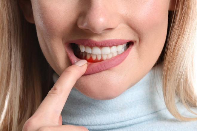 Cảnh báo: Răng không khỏe có thể dẫn đến chứng mất trí nhớ, sa sút trí tuệ - 1