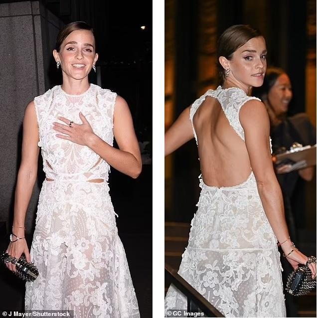Emma Watson lộ da lão hóa - 2