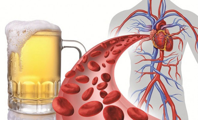 Uống nhiều rượu bia làm tăng huyết áp và nhiều biến chứng nguy hiểm.