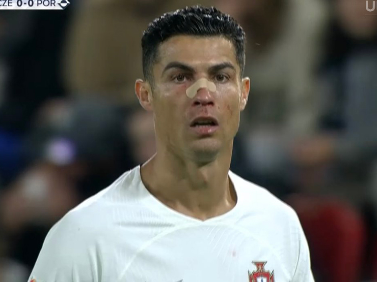 Ronaldo bất ngờ đen đủ đường: Đổ máu từ rất sớm, suýt sắm vai ”tội đồ”