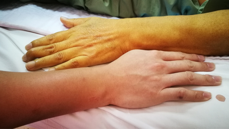 Lá gan quý hơn vàng đang "kêu cứu" nếu cơ thể có 5 dấu hiệu này - 1