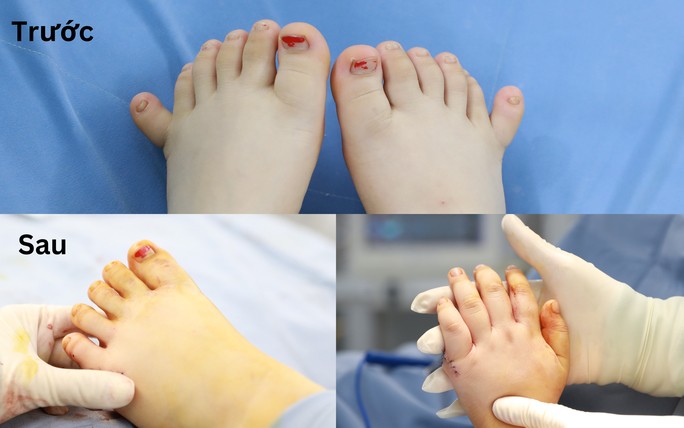 Hiếm gặp: Bé gái ở Quảng Nam có 12 ngón tay, 12 ngón chân - 2