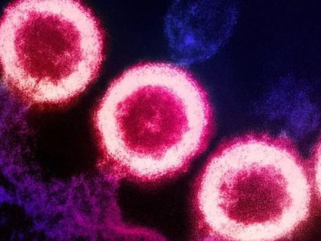 Thông tin thêm về người phụ nữ đầu tiên được ghép tế bào gốc chữa khỏi HIV
