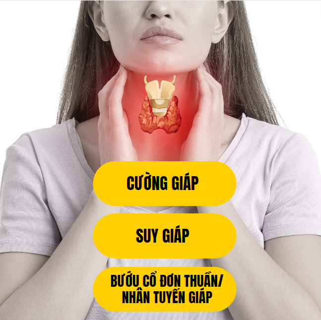 Bất ngờ với công dụng cải thiện bướu cổ nhanh hơn, mạnh hơn từ thiên nhiên - 1