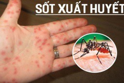 Gần 900 người ở Hà Nội nhập viện vì sốt xuất huyết trong 4 ngày nghỉ lễ, những sai lầm mọi người nên tránh