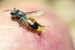 Người đàn ông bị ong đốt hơn 300 nốt, bác sĩ chỉ cách sơ cứu khi bị ong tấn công