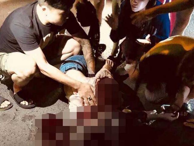 Vụ cô gái bị đâm trên phố Bùi Thị Xuân: Nghi phạm gọi điện báo cho mẹ nạn nhân 1539526899 327 15395268801717 thumbnail Vụ cô gái bị đâm trên phố Bùi Thị Xuân: Nghi phạm gọi điện báo cho mẹ nạn nhân