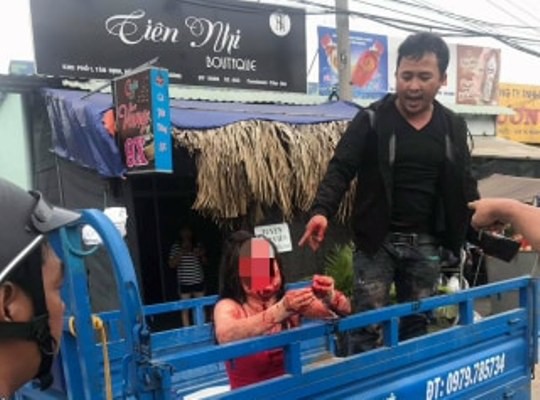 Nữ nhân viên quán cà phê chòi nghi bị khách đánh dã man - 3