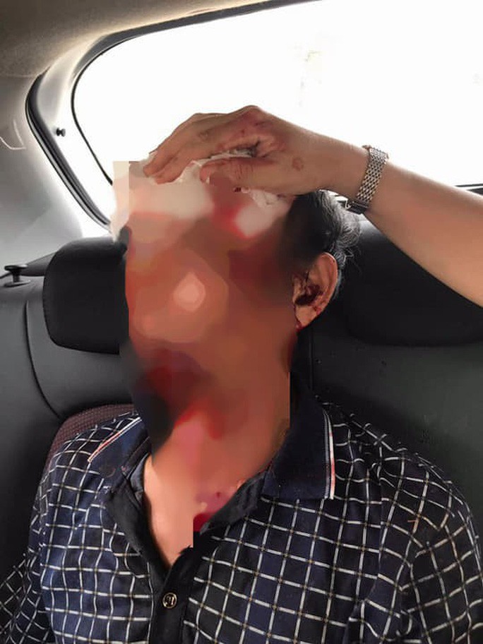 Clip: Nhóm thanh niên ném đá rào rào vào nhà vụ 3 người bị bắn trọng thương - 2