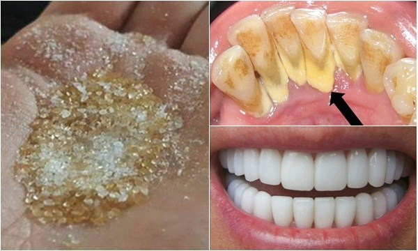 6 cách làm trắng răng tại nhà hiệu quả nhất nhất định phải thử ngay