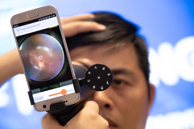 Kiểm tra mắt bị thoái hóa điểm vàng: Samsung tìm ra cách đo nhanh và chính xác - 1