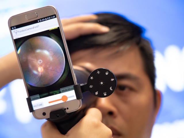 Kiểm tra mắt bị thoái hóa điểm vàng: Samsung tìm ra cách đo nhanh và chính xác
