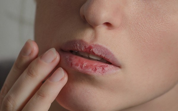 Dấu hiệu gan đang "kêu cứu", đừng bỏ qua kẻo "hối không kịp" - 2