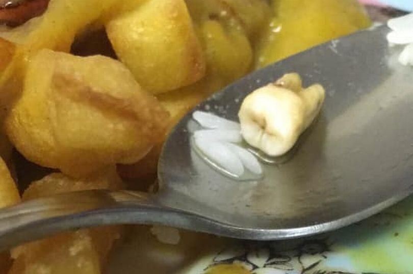 Mỹ: Đi ăn món Trung Quốc, cặp đôi hãi hùng khi phát hiện… răng người bên trong - 1
