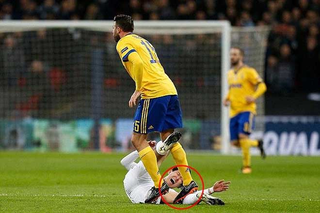 Son Heung-min đốn giò SAO Everton: Không ác ý, nhưng đôi lúc "máu nóng" - 6