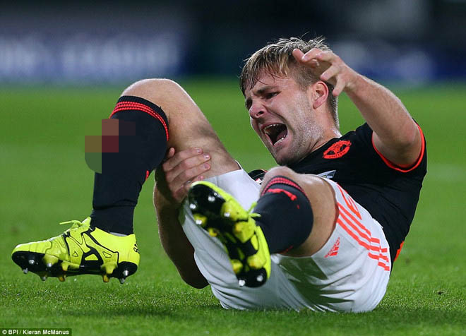 Rùng rợn SAO Everton chấn thương vì Son Heung-min: Lâm cảnh như SAO MU, Liverpool - 2