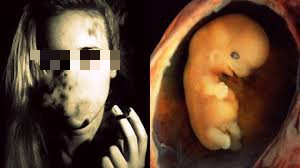 Tác hại đáng sợ của thuốc lá đối với sức khỏe sinh sản nữ giới - 1