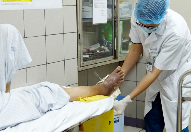 Nhiều người Việt đang sống với căn bệnh gây biến chứng mù mắt, cắt cụt chi mà không biết - 1