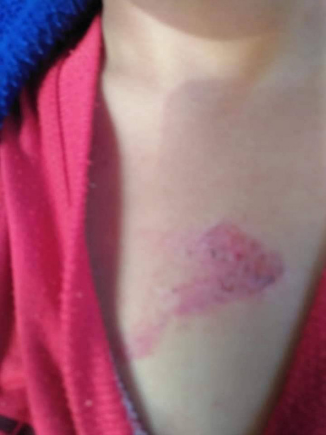 Một cháu bé 6 tuổi nghi bị chính mẹ ruột đánh dã man - 3