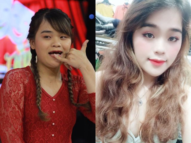 ”Thánh sún” được Ngô Kiến Huy tài trợ làm răng bị chỉ trích, tiết lộ không ngờ về 100 triệu tiền thưởng