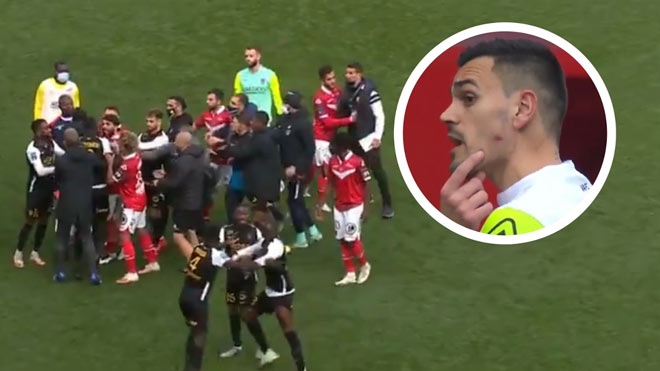 SAO bóng đá Pháp hóa "Suarez 2.0" cắn đối thủ, sắp có án phạt nặng - 1